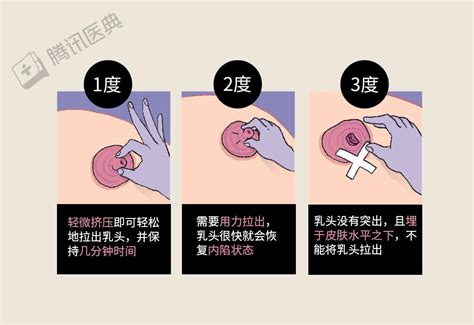 乳頭有毛|乳头边上有毛毛正常吗？10 个你需要知道的小问题